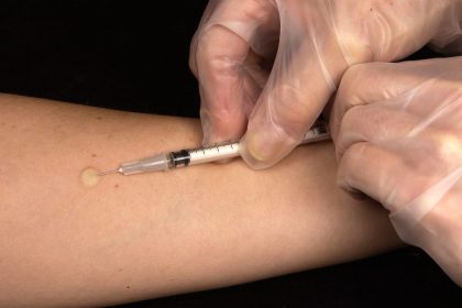 Aplicação da Prova Tuberculínica (PPD) passa a ser realizada em novo endereço em Três Lagoas